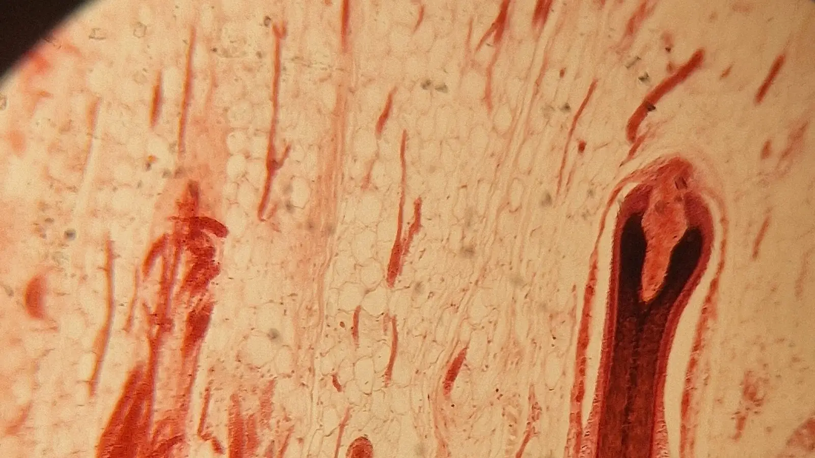 Stained microscope section of skin showing a hair follicle with its rounded bulb at the base